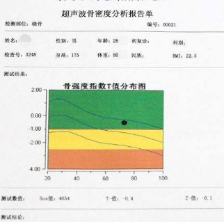 骨密度检测仪针对骨密度检测结果的分析